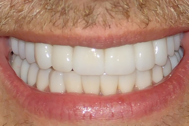 Realizacja 4